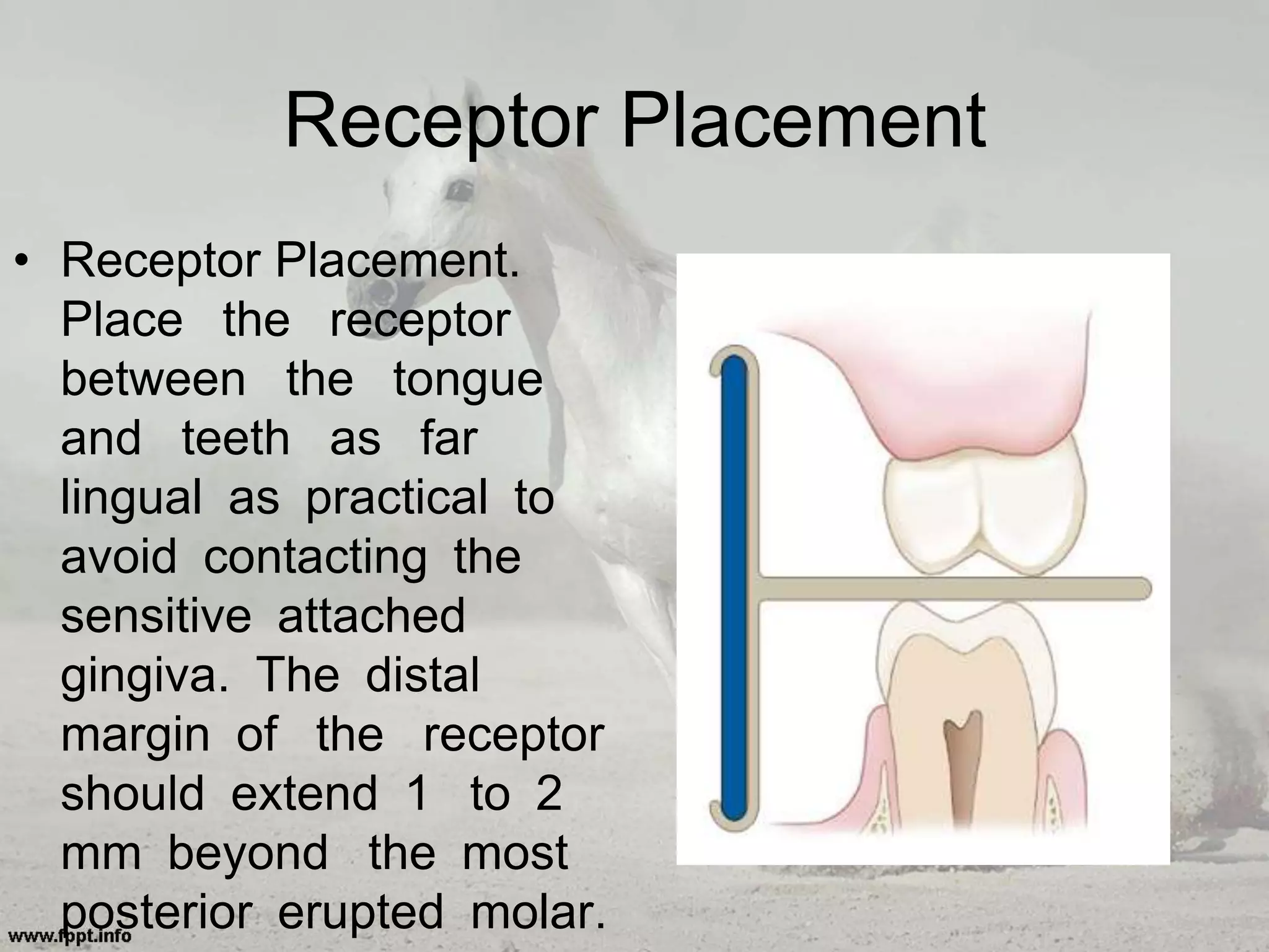 Receptor Placement
• Receptor Placement.
Place the receptor
between the tongue
and teeth as far
lingual as practical to
avoid contacting the
sensitive attached
gingiva. The distal
margin of the receptor
should extend 1 to 2
mm beyond the most
posterior erupted molar.
 