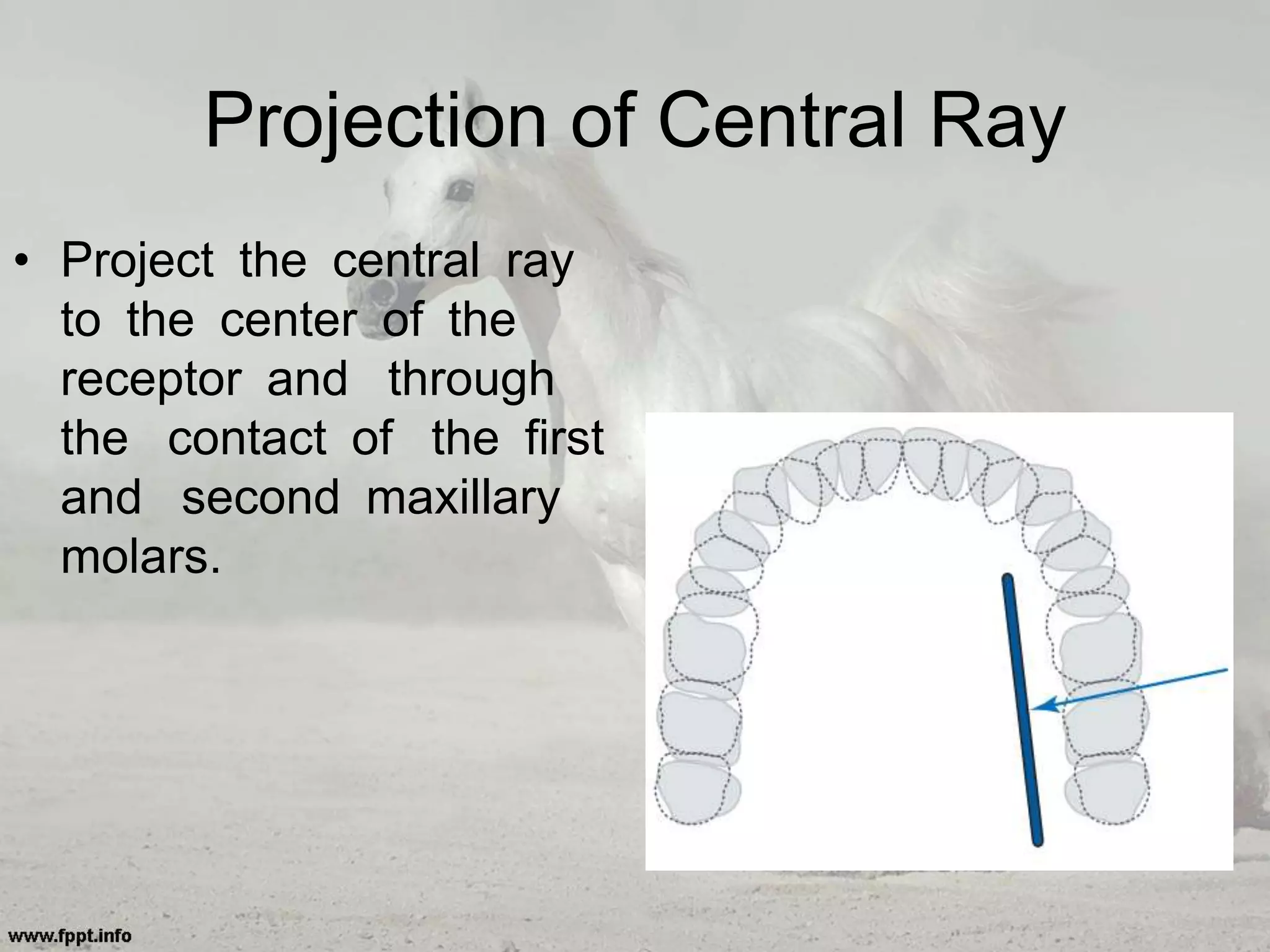 Projection of Central Ray
• Project the central ray
to the center of the
receptor and through
the contact of the first
and second maxillary
molars.
 