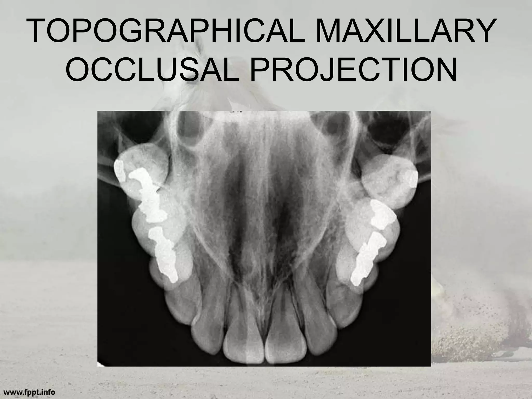 TOPOGRAPHICAL MAXILLARY
OCCLUSAL PROJECTION
 