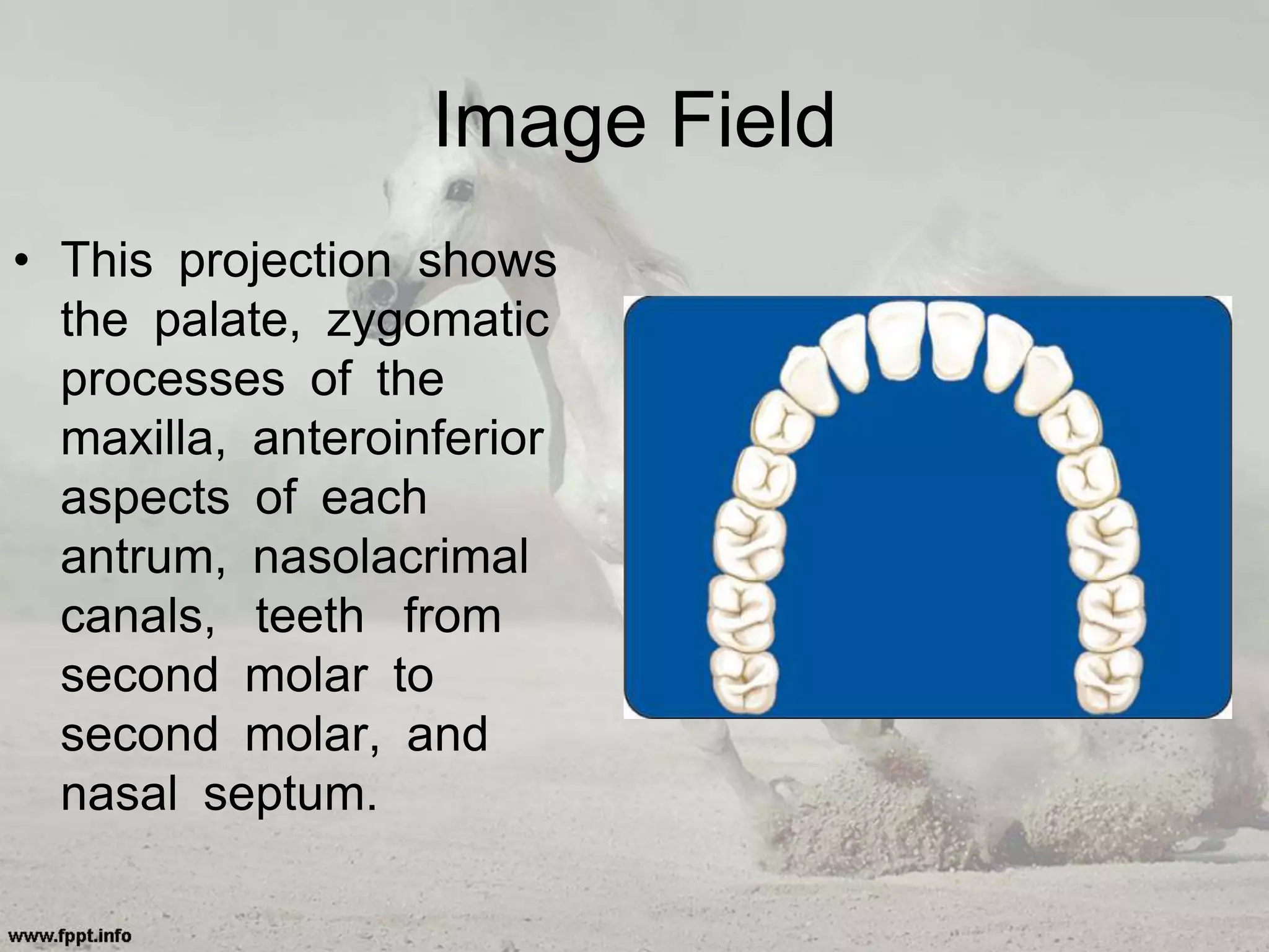 Image Field
• This projection shows
the palate, zygomatic
processes of the
maxilla, anteroinferior
aspects of each
antrum, nasolacrimal
canals, teeth from
second molar to
second molar, and
nasal septum.
 