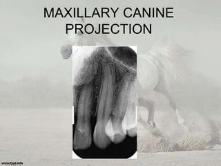 intraoral projection | PPTX