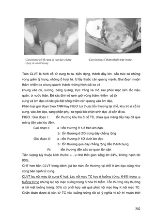 Carcinoma cæ tö cung di c¨n d©y ch»ng
réng vµ c¬ bÞt trong

Carcinoma cæ th©m nhiÔm trùc trµng

Trên CLVT là hình cổ tử cung to ra, biến dạng, thành dầy lên, cấu trúc có những
vùng giảm tỷ trọng, những ổ hoại tử. U lấy thuốc cản quang mạnh. Giai đoạn muộn
thâm nhiễm ra chung quanh thành những hình dải xơ và
khung vào cơ, xương, bàng quang, trực tràng và mô sau phúc mạc làm tắc niệu
quản, ứ nước thận. Để xác định rõ ranh giới vùng thâm nhiễm cổ tử
cung và âm đạo có tác giả đặt bông thấm cản quang vào âm đạo.
Phân loại giai đoạn theo TNM hay FIGO tuỳ thuộc tổn thương tại chỗ, khu trú ở cổ tử
cung, vào âm đạo, sang phần phụ, ra ngoài bộ phận sinh dục ,di cân đi xa.
FIGO : Giai đoạn I :

tổn thương khu trú ở cổ TC, chưa qua màng đáy hay đã qua

màng đáy vào lớp đệm.
Giai đoạn II

a : tổn thương ở 1/3 trên âm đạo.
b : tổn thương ở 2/3 trong dây chằng rộng

Giai đoạn III

a : tổn thương ở 1/3 dưới âm đạo
b : tổn thương qua dây chằng rộng đến thành bụng.

IV:

tổn thương đến các cơ quan lân cận

Tiên lượng tuỳ thuộc kích thước u , u nhỏ thời gian sống tới 94%, không hạch tới
80%.
CHT hơn hẳn CLVT trong đánh giá lan tràn tổn thương tại chỗ ở âm đạo cũng như
cũng bên cạnh tử cung.
CLVT lạc nội mạc tử cung K hoá. Lạc nội mạc TC hay ở buồng trứng, 6-8% trong u
buồng trứng nhưng lạc nội mạc buồng trứng K hóa thì hiếm. Tổn thương này thường
ở bề mặt buồng trứng. 30% có phối hợp với quá phát nội mạc hay K nội mạc TC.
Chẩn đoán được di căn từ TC vào buồng trứng rất có ý nghĩa vì sử trí muộn thời

302

 