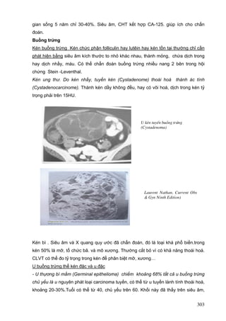 gian sống 5 năm chỉ 30-40%. Siêu âm, CHT kết hợp CA-125. giúp ích cho chẩn
đoán.
Buồng trứng
Kén buồng trứng Kén chức phận folliculin hay lutêin hay kén tồn tại thường chỉ cần
phát hiện bằng siêu âm kích thước to nhỏ khác nhau, thành mỏng, chứa dịch trong
hay dịch nhầy, máu. Có thể chẩn đoán buồng trứng nhiều nang 2 bên trong hội
chứng Stein -Leventhal.
Kén ung thư. Do kén nhầy, tuyến kén (Cystadenome) thoái hoá

thành ác tính

(Cystadenocarcinome). Thành kén dầy không đều, hay có vôi hoá, dịch trong kén tỷ
trọng phải trên 15HU.

U kÐn tuyÕn buång trøng
(Cystadenoma)

Laurent Nathan, Current Obs
& Gyn Ninth Edition)

Kén bì . Siêu âm và X quang quy ước đã chẩn đoán, đó là loại khá phổ biến.trong
kén 50% là mỡ, tổ chức bã. và mô xương. Thường cắt bỏ vì có khả năng thoái hoá.
CLVT có thể đo tỷ trọng trong kén để phân biệt mỡ, xương…
U buồng trứng thể kén đặc và u đặc
- U thựơng bì mầm (Germinal epithelioma) chiếm khoảng 68% tất cả u buồng trứng
chủ yếu là u nguyên phát loại carcinoma tuyến, có thể từ u tuyến lành tính thoái hoá,
khoảng 20-30%.Tuổi có thể từ 40, chủ yếu trên 60. Khối này đã thấy trên siêu âm,

303

 