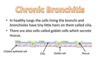 • In healthy lungs the cells lining the bronchi and 
bronchioles have tiny little hairs on them called cilia. 
• There are also cells called goblet cells which secrete 
mucus. 
Ciliated epithelial cell 
Cilia Goblet cell Mucus 
 