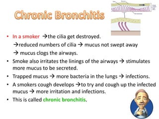 • In a smoker the cilia get destroyed. 
reduced numbers of cilia  mucus not swept away 
 mucus clogs the airways. 
• Smoke also irritates the linings of the airways  stimulates 
more mucus to be secreted. 
• Trapped mucus  more bacteria in the lungs  infections. 
• A smokers cough develops to try and cough up the infected 
mucus  more irritation and infections. 
• This is called chronic bronchitis. 
 