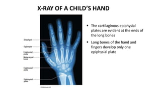 X-RAY OF A CHILD’S HAND
 The cartilaginous epiphysial
plates are evident at the ends of
the long bones
 Long bones of the hand and
fingers develop only one
epiphysial plate
© McGraw-Hill
 