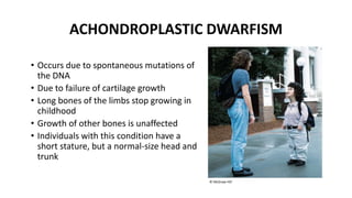 ACHONDROPLASTIC DWARFISM
• Occurs due to spontaneous mutations of
the DNA
• Due to failure of cartilage growth
• Long bones of the limbs stop growing in
childhood
• Growth of other bones is unaffected
• Individuals with this condition have a
short stature, but a normal-size head and
trunk
© McGraw-Hill
 