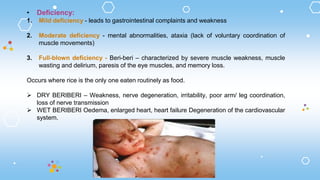 • Deficiency:
1. Mild deficiency - leads to gastrointestinal complaints and weakness
2. Moderate deficiency - mental abnormalities, ataxia (lack of voluntary coordination of
muscle movements)
3. Full-blown deficiency - Beri-beri – characterized by severe muscle weakness, muscle
wasting and delirium, paresis of the eye muscles, and memory loss.
Occurs where rice is the only one eaten routinely as food.
 DRY BERIBERI – Weakness, nerve degeneration, irritability, poor arm/ leg coordination,
loss of nerve transmission
 WET BERIBERI Oedema, enlarged heart, heart failure Degeneration of the cardiovascular
system.
 