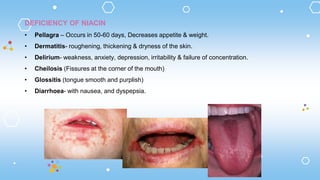 DEFICIENCY OF NIACIN
• Pellagra – Occurs in 50-60 days, Decreases appetite & weight.
• Dermatitis- roughening, thickening & dryness of the skin.
• Delirium- weakness, anxiety, depression, irritability & failure of concentration.
• Cheilosis (Fissures at the corner of the mouth)
• Glossitis (tongue smooth and purplish)
• Diarrhoea- with nausea, and dyspepsia.
 