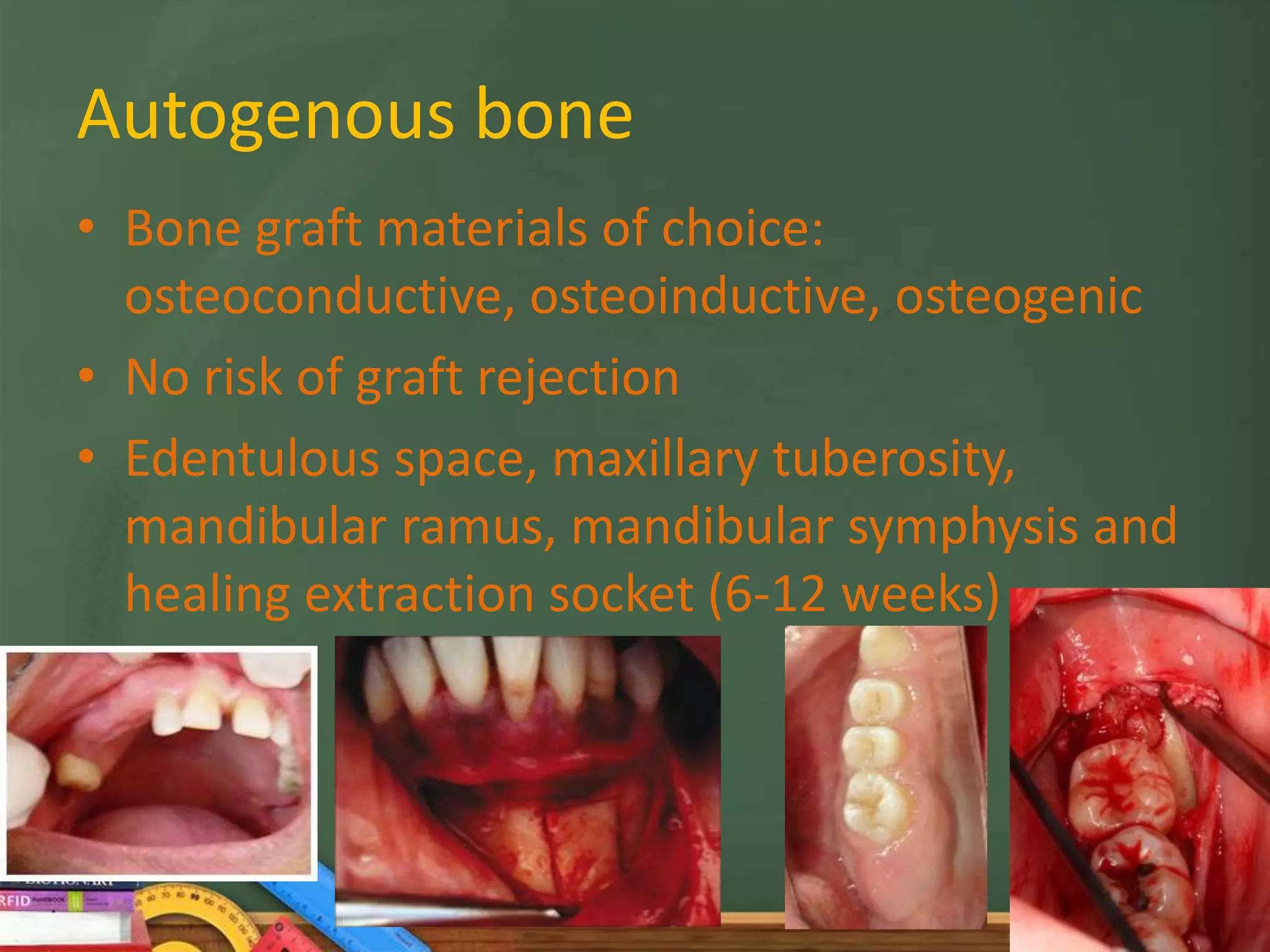 Localized bone augmentation and implant site development | PPTX