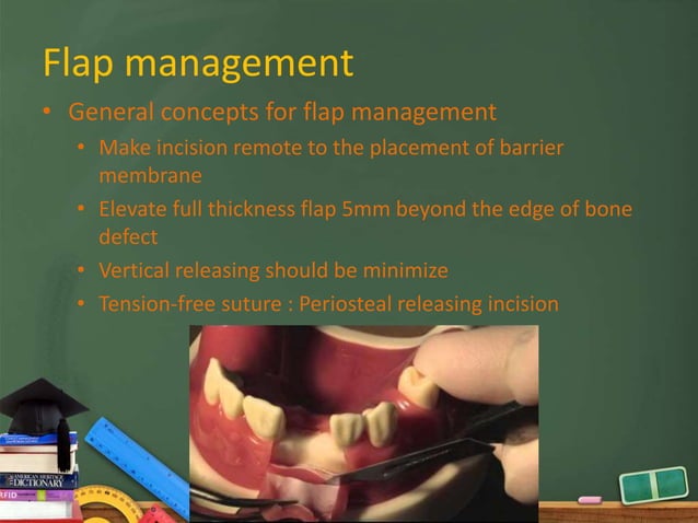 Localized bone augmentation and implant site development | PPTX