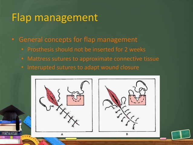 Localized bone augmentation and implant site development | PPTX