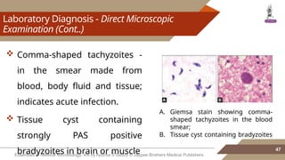 Comprehensive Overview of Parasitic and Fungal CNS Infections | PPTX