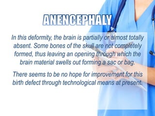 In this deformity, the brain is partially or almost totally
absent. Some bones of the skull are not completely
formed, thus leaving an opening through which the
brain material swells out forming a sac or bag.
There seems to be no hope for improvement for this
birth defect through technological means at present.
 