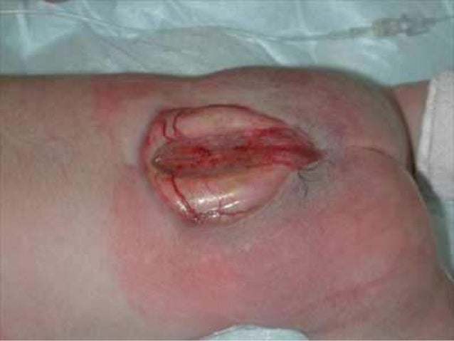 bioethics birth deformities