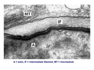A = actin, IF = intermediate filament, MT = microtubule
 