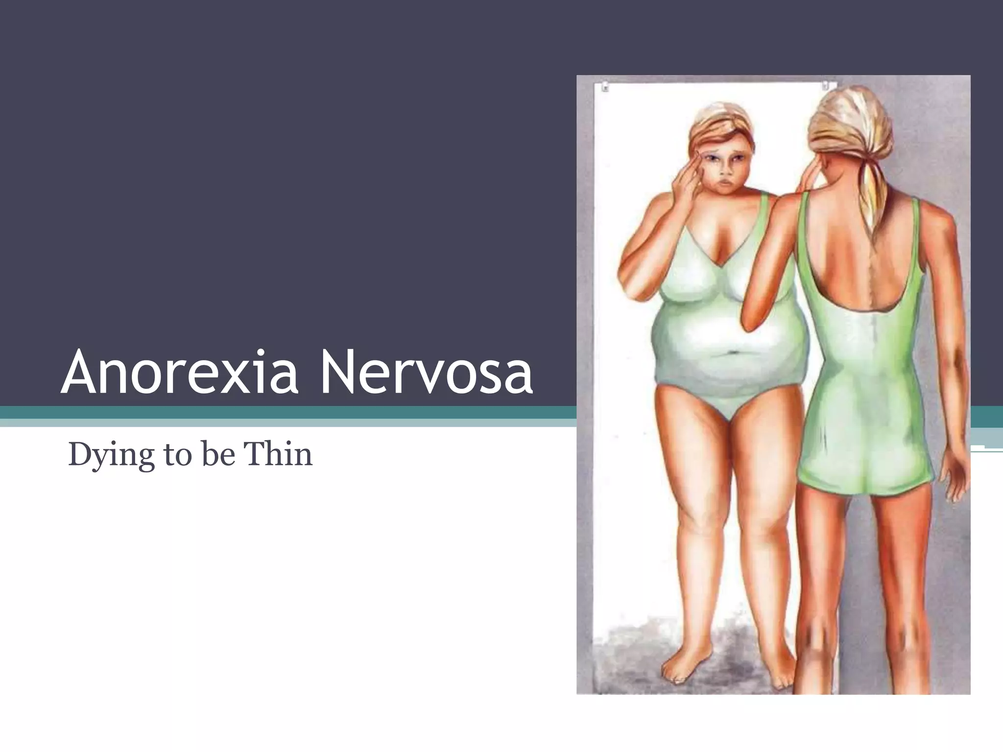 Anorexia Nervosa
Dying to be Thin
 