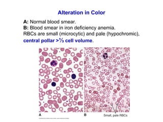 Chapter 7 part I_Abnormalities size, color and distribution.ppt