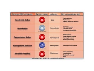 Red Blood Cell Inclusions Chart.pdf chapter 7 part II_Erythrocyte Inclusions.pptx