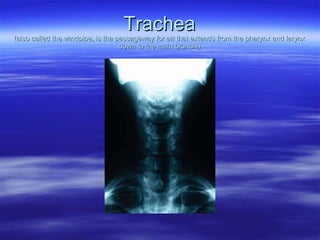 Trachea (also called the windpipe, is the passageway for air that extends from the pharynx and larynx down to the main bronchi) 