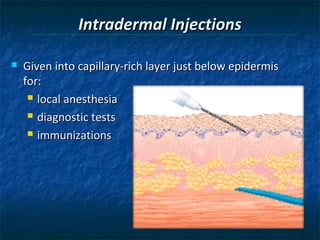 Intradermal Injections

   Given into capillary-rich layer just below epidermis
    for:
      local anesthesia

      diagnostic tests

      immunizations
 