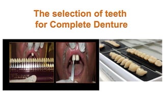The selection of teeth
for Complete Denture
 
