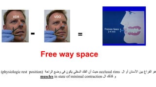 - =
Free way space
‫ال‬ ‫أو‬ ‫األسنان‬ ‫بين‬ ‫الفراغ‬ ‫هو‬occlusal rims‫الراحة‬ ‫وضع‬ ‫في‬ ‫يكون‬ ‫السفلي‬ ‫الفك‬ ‫أن‬ ‫حيث‬(physiologic rest position)
‫ال‬ ‫كذلك‬ ‫و‬in state of minimal contractionmuscles
 