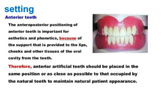 Teeth selection for complete denture                   
