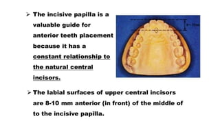 Teeth selection for complete denture                   