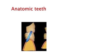 Teeth selection for complete denture                   