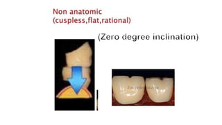 Teeth selection for complete denture                   