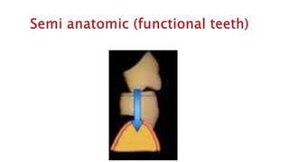 Teeth selection for complete denture                   