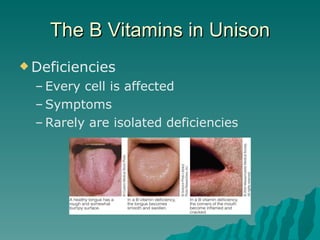 The B Vitamins in Unison Deficiencies Every cell is affected Symptoms  Rarely are isolated deficiencies 