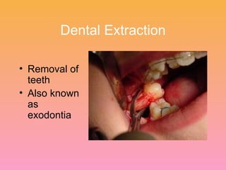 Dental Extraction Removal of teeth Also known as exodontia 