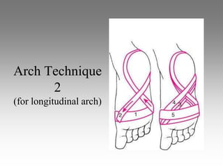 Arch Technique
      2
(for longitudinal arch)
 