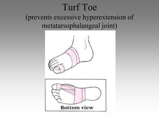 Turf Toe
(prevents excessive hyperextension of
     metatarsophalangeal joint)
 
