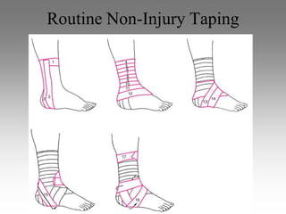 Routine Non-Injury Taping
 