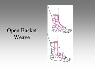 Open Basket
  Weave
 