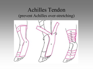 Achilles Tendon
(prevent Achilles over-stretching)
 