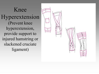 Knee
Hyperextension
    (Prevent knee
  hyperextension,
 provide support to
injured hamstring or
 slackened cruciate
      ligament)
 