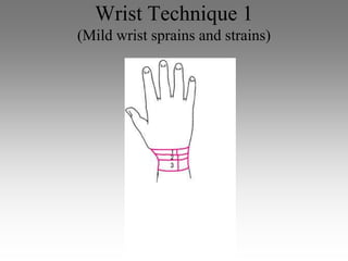 Wrist Technique 1
(Mild wrist sprains and strains)
 