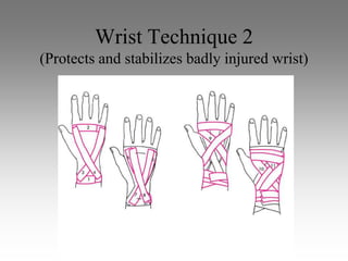 Wrist Technique 2
(Protects and stabilizes badly injured wrist)
 