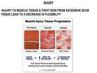 INJURY
-INJURY TO MUSCLE TISSUE & TIGHT SKIN FROM EXCESSIVE SCAR
TISSUE LEAD TO A DECREASE IN FLEXIBILITY
 
