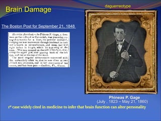 (July , 1823 – May 21, 1860)
Phineas P. Gage
The Boston Post for September 21, 1848
1st case widely cited in medicine to infer that brain function can alter personality
daguerreotype
Brain Damage
 