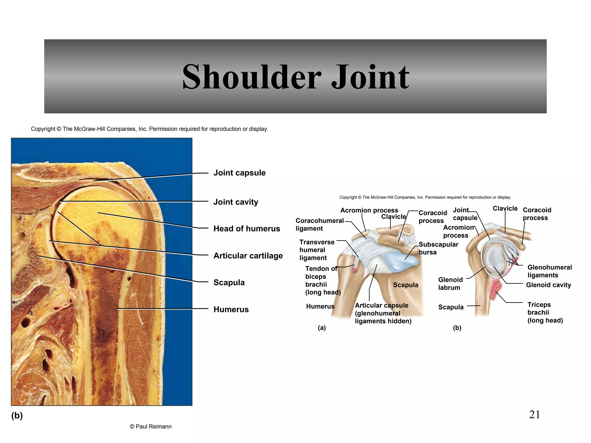 Shoulder Joint Copyright © The McGraw-Hill Companies, Inc. Permission required for reproduction or display. © Paul Reimann Head of humerus Joint cavity Joint capsule Articular cartilage Scapula Humerus (b) Coracohumeral ligament Transverse humeral ligament Tendon of biceps brachii (long head) Acromion process Clavicle Coracoid process Acromion process Subscapular bursa Joint capsule Coracoid process Clavicle Glenohumeral ligaments Glenoid cavity Triceps brachii (long head) Glenoid labrum Scapula Humerus Scapula Articular capsule (glenohumeral ligaments hidden) (a) (b) Copyright © The McGraw-Hill Companies, Inc. Permission required for reproduction or display. 