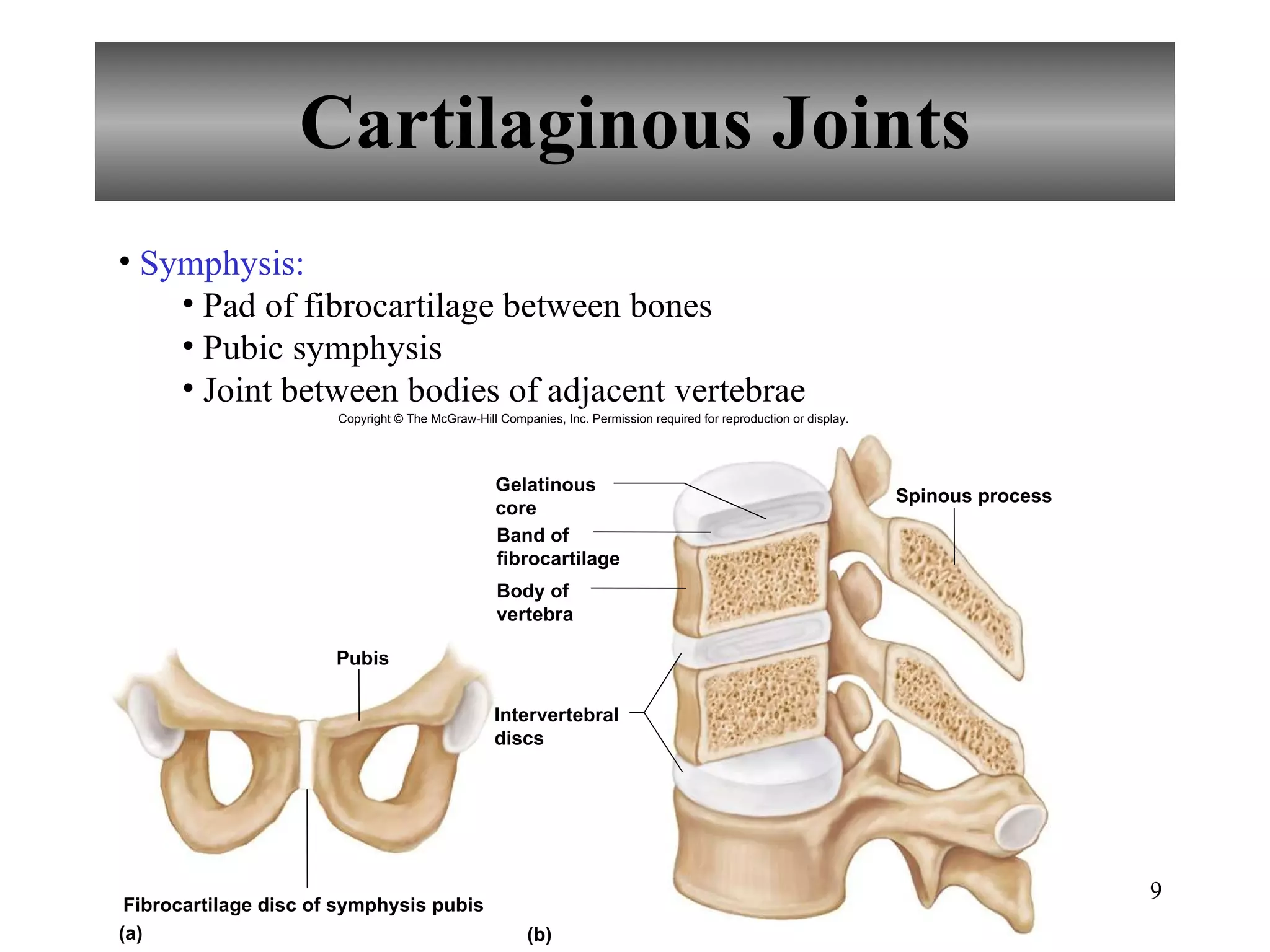 Cartilaginous Joints Symphysis: Pad of fibrocartilage between bones Pubic symphysis Joint between bodies of adjacent vertebrae Copyright © The McGraw-Hill Companies, Inc. Permission required for reproduction or display. Gelatinous core Spinous process Band of fibrocartilage Pubis Fibrocartilage disc of symphysis pubis Intervertebral discs (a) (b) Body of vertebra 