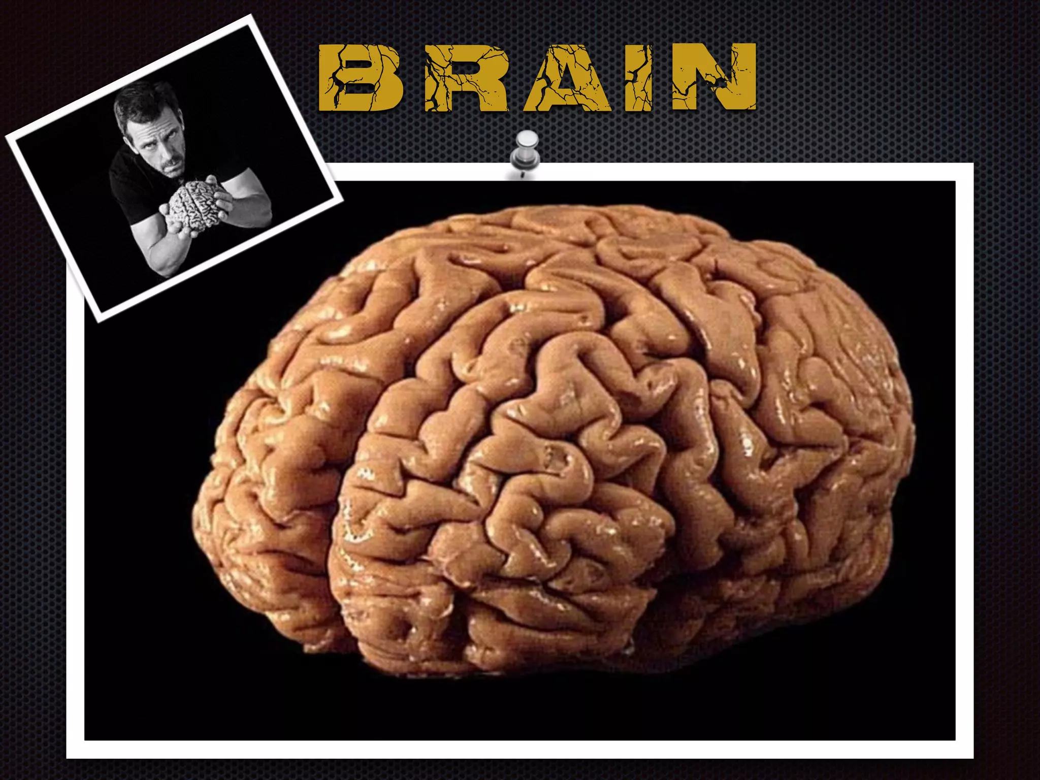 B R A I N
 