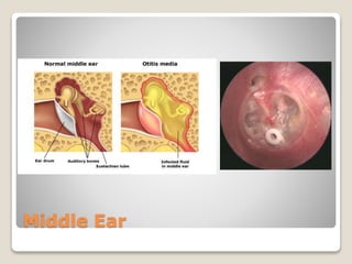 Middle Ear
 