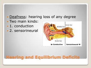 Hearing and Equilibrium Deficits
 Deafness: hearing loss of any degree
 Two main kinds:
 1. conduction
 2. sensorineural
 