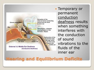 Hearing and Equilibrium Deficits
 Temporary or
permanent
conduction
deafness results
when something
interferes with
the conduction
of sound
vibrations to the
fluids of the
inner ear
 